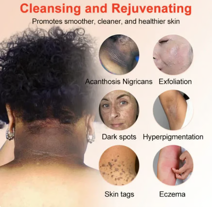 Orange Enzyme Exfoliating Gel